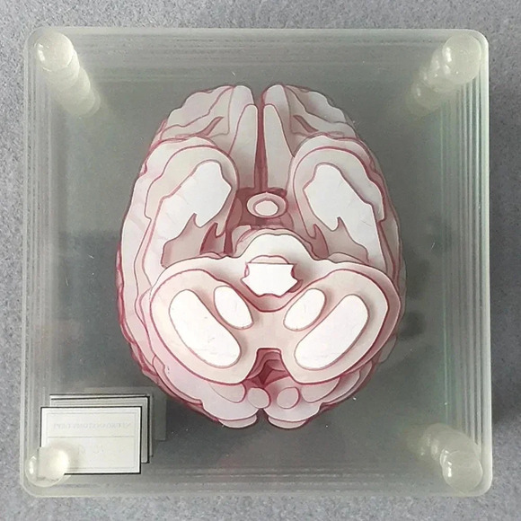 10 Brain specimen coasters - Picture 3 of 4